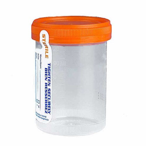 Globe Scientific 6529 TiteRite™ 120mL Urine Specimen Containers with Attac